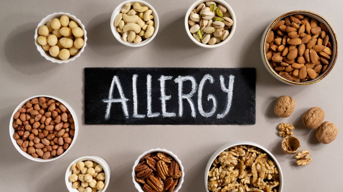 Le quotidien avec les allergies - les personnes concernées doivent faire attention à ces points en ce qui concerne les aliments.